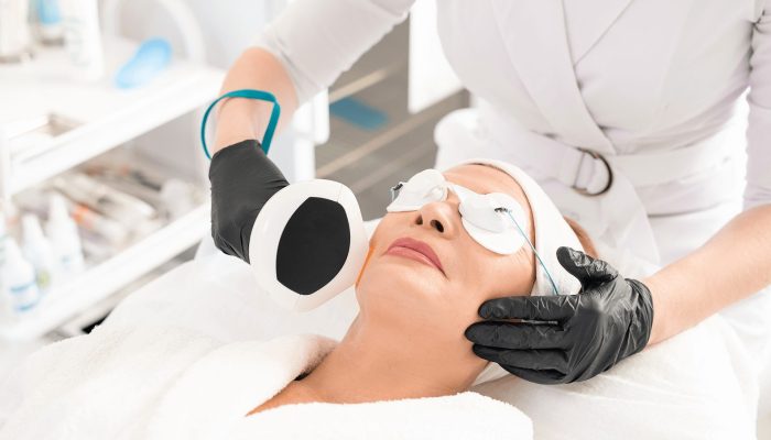 anti-aging-laser-procedure-6WBVBV9 (1)