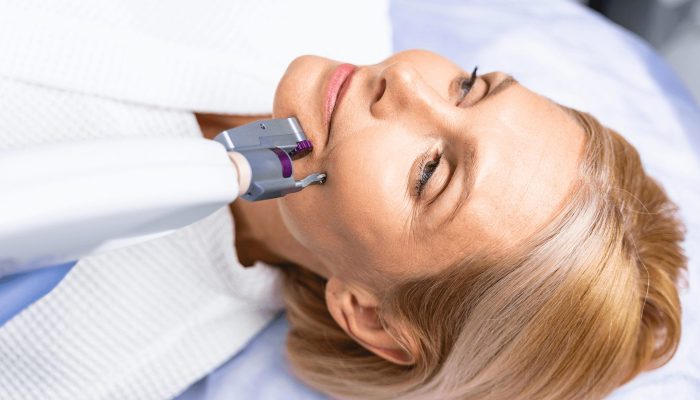 blonde-lady-undergoing-an-anti-aging-skin-procedur-6XF7RHR (1)