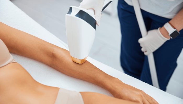 client-undergoing-a-laser-hair-removal-in-a-beauty-UWXPA27 (1)